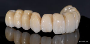 1061-ZirCAD_Prime_Ästhetik06