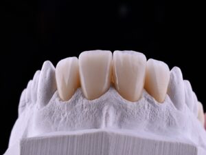 Webp.net-resizeimage (6)